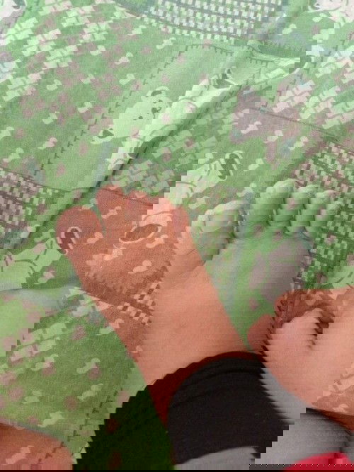 อยากสอบถามแม่ๆหน่อยค่ะพอดีว่าตั้งครรภ์ได้ 37 สัปดาห์แล้วมีอาการเท้าบวมแต่ไม่บวมมากกดลงไปขึ้นเป็นอย่า