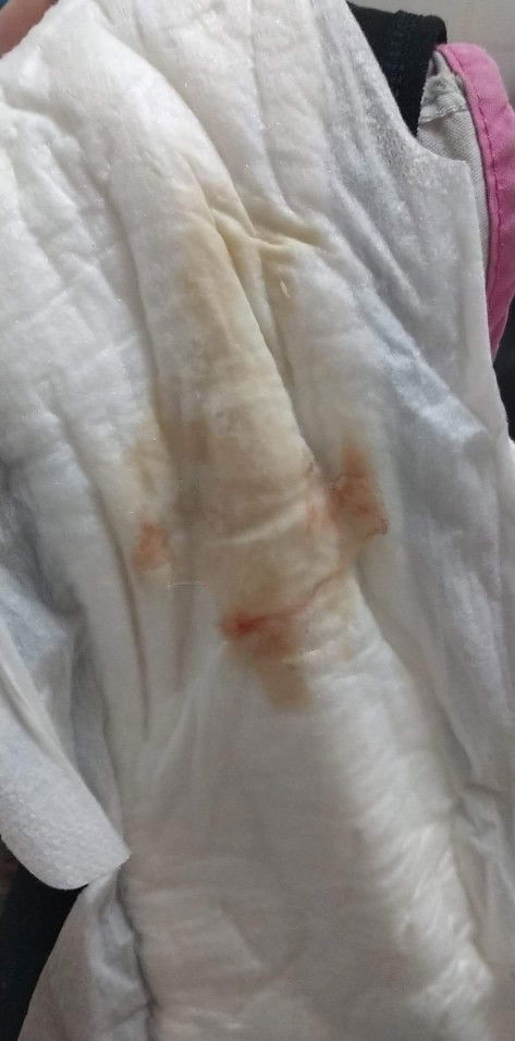 มีมูกเลือด