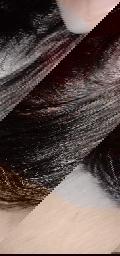 mirip bisul di kepala bayi