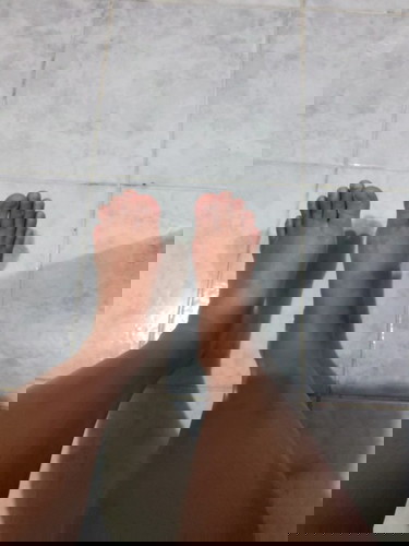 32w บวมแบบนี้แปลว่าอะไร