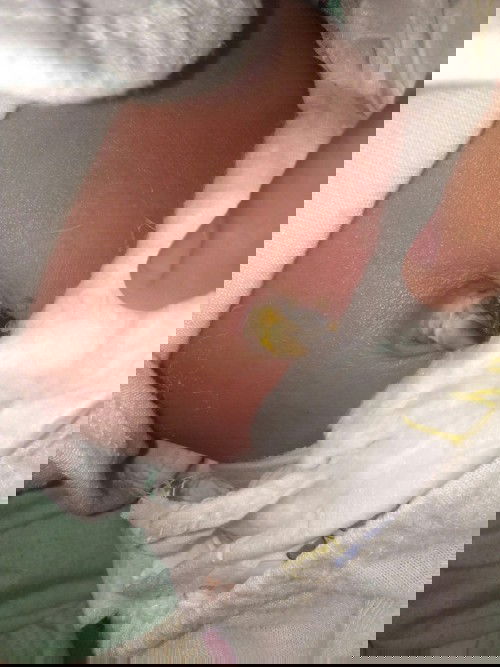 21 days pusod ni baby