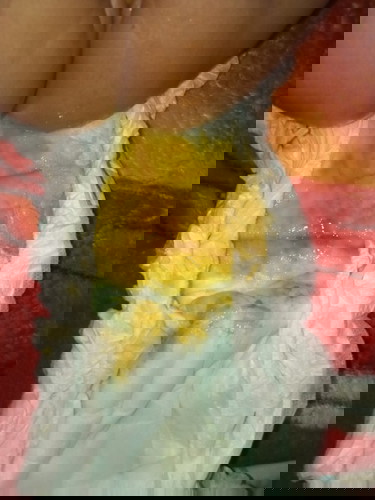 normal po ba o hindi??