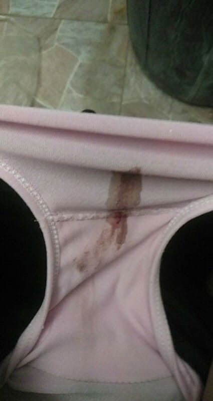 ใครมีประสบการณ์บ้างคะ ท้องสอง7วีค2วัน ไปฝากท้องเจอถุงตั้งครรภ์ มีเลือดออกแบบนี้มาสองวัน แล้วคะทำไงดี