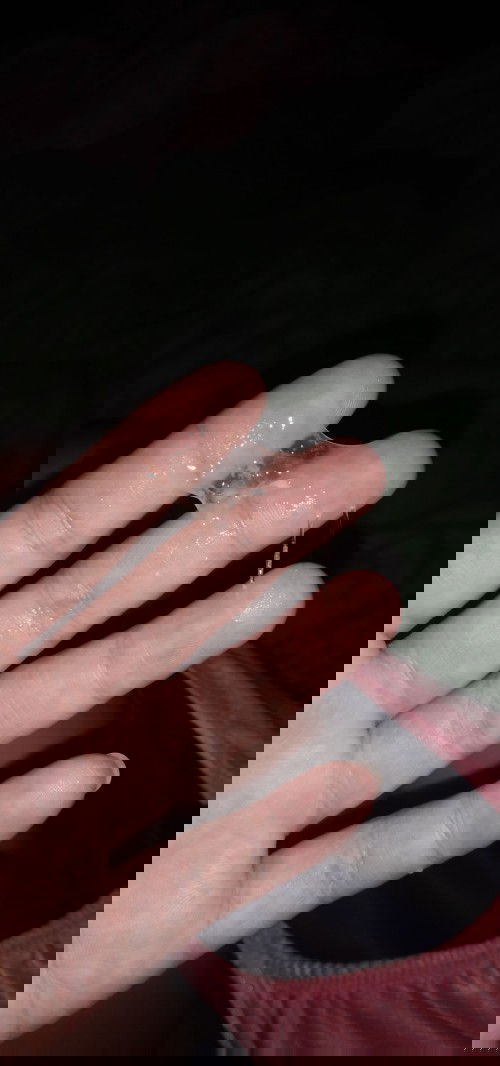 ใครรู้ช่วยบอกหน่อยค่ะกังวลมากๆ