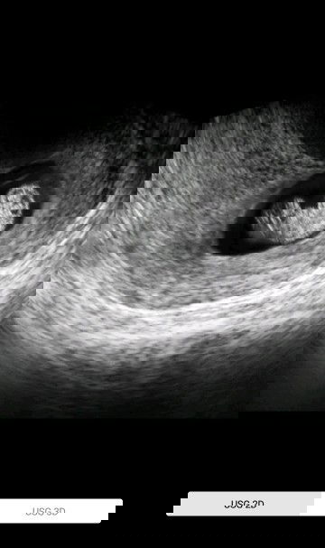 Ketika hamil muda banyak mual dan muntah anak kelak bakal rewel