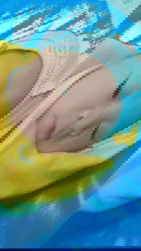 คลอดก่อนกำหนด