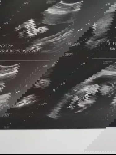 baby boy??