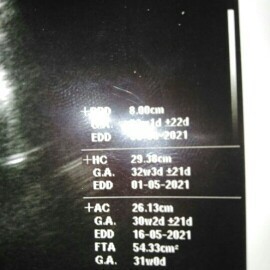 ขอถามแม่ๆหน่อยค่ะ FTA 54.33cm นี้คืออะไรหรอคะ