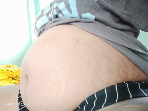 32W5D ท้องอยู่ต่ำมาก เวลาเดินลำบากมาก ท้องเหมือนจะกลมแบบนี้มีสิทธิ์น้องจะเป็นหญิงรึป่าวค่ะ อยากรู้