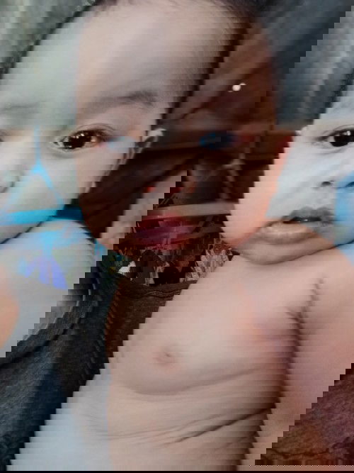 ไอ น้ำมูกเสมหะ