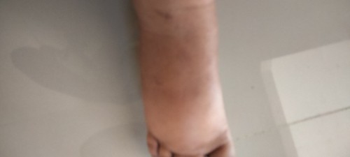 มื้อชา
เท้าบวกต้องทำยังไงค่ะ