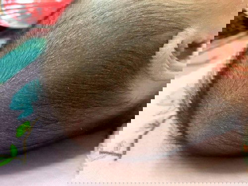 Bé bị tróc da đầu