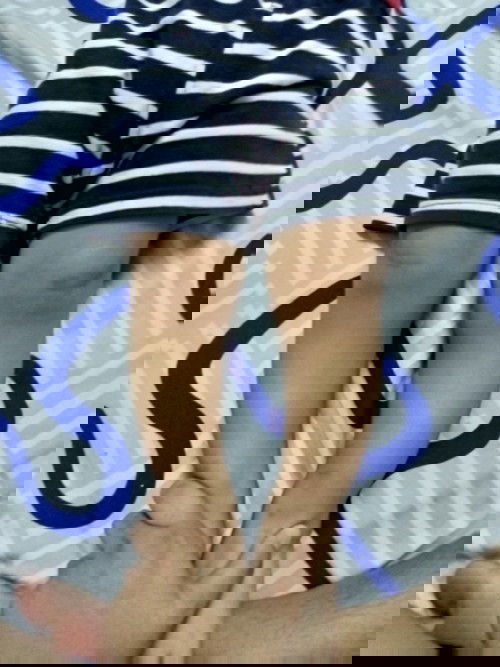 ขาโก่งเเบบนี้เป็นขาโก่งปกตมั้ยหรือผิดปกติ 1.6 ขวบ