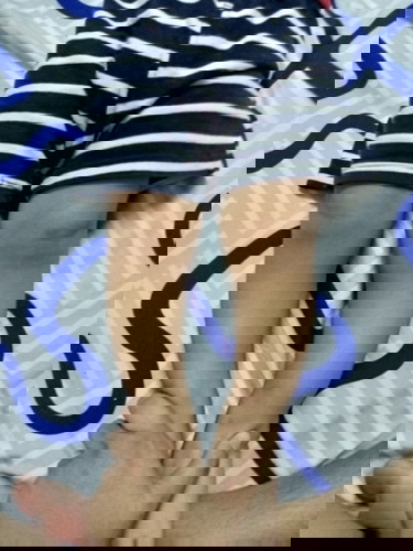 ขาโก่งเเบบนี้เป็นขาโก่งปกตมั้ยหรือผิดปกติ 1.6 ขวบ