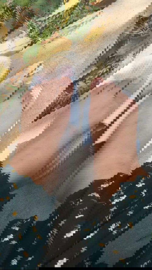 เท้าบวมแบบนี้ใกล้คลอด หรืออันตรายไหม??