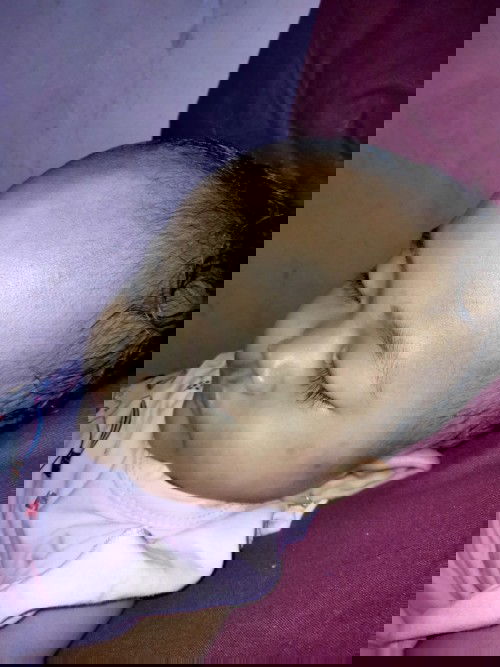 Garis seperti tulang