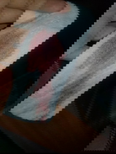 Painless placenta previa totalis!😔😔naiiyak nalang ako kapag lumalabas yung bleed