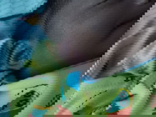 Bintik putih pada wajah bayi