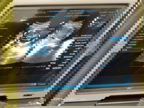 HPL ganti² tiap USG