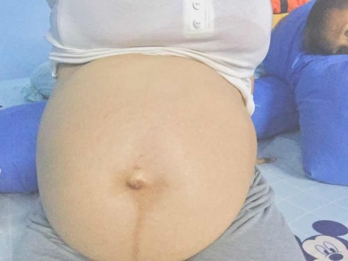 27w2dจร้า เเม่ๆว่าท้องเเบบนี้จะได้ลูกสาวหรือลูกชายคะ🥰🥰
