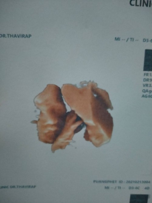 Post reply image
