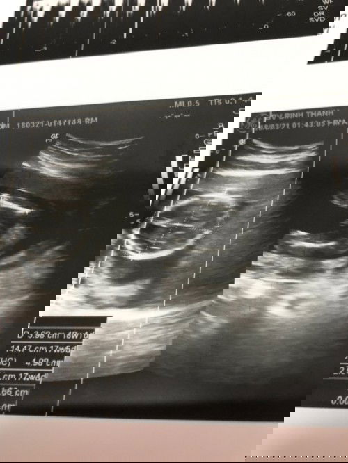 Hi các mom, Các mom xem hình và đoán giúp e nhé!😊