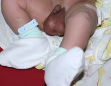 Mohon info obatnya bagi ibu2 yang tau...
Ank saya baru lahir tapi telur di kelaminnya bengkak sebela