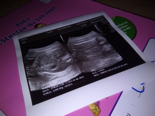 Janin kecil / berat janin kurang