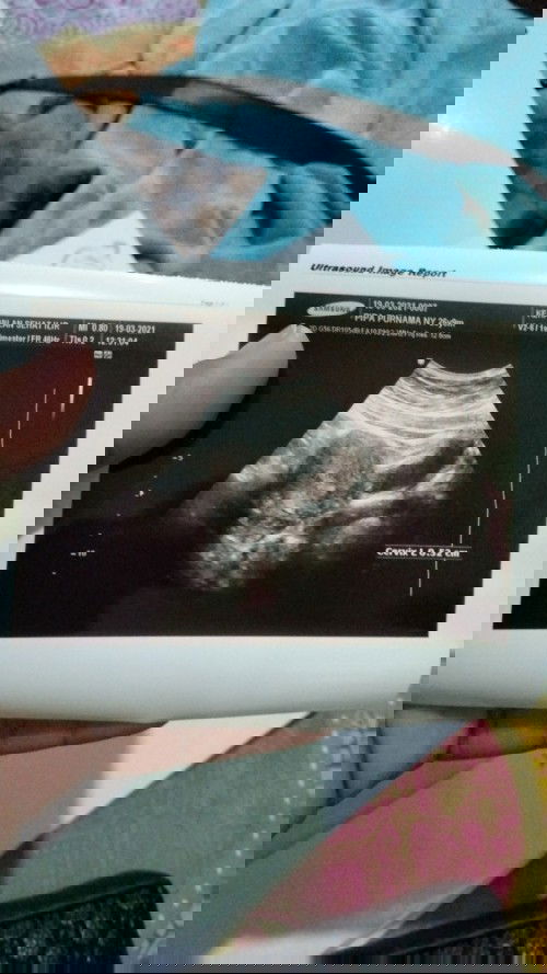 Telat 3 hri tespek positif apakah hamil?