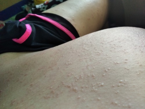 Im so Depressed 😢