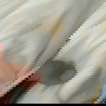 bercak coklat pada popok