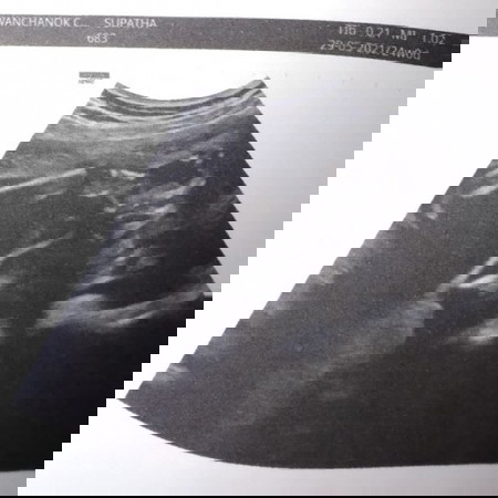 แม่ๆคนไหนดูออกมั่งคะ ว่า ญ หรือ ช