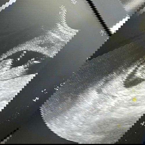 ดูออกไหมคะว่าหญิงหรือชาย?