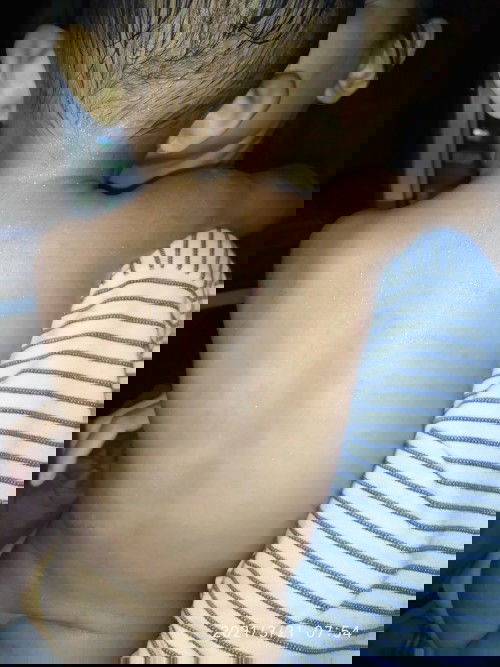 Bercak merah di seluruh badan