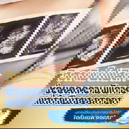 โฟลิกช่วยลดความพิการแต่กำเนิดของทารก