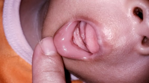 Apakah ini akan tumbuh gigi