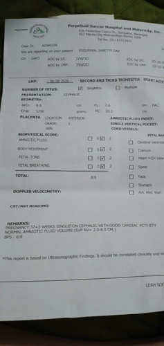 EDD q po nung 15  pero base on my UTS is 28,kinakabhan po aq kc until now no sign of labor padin