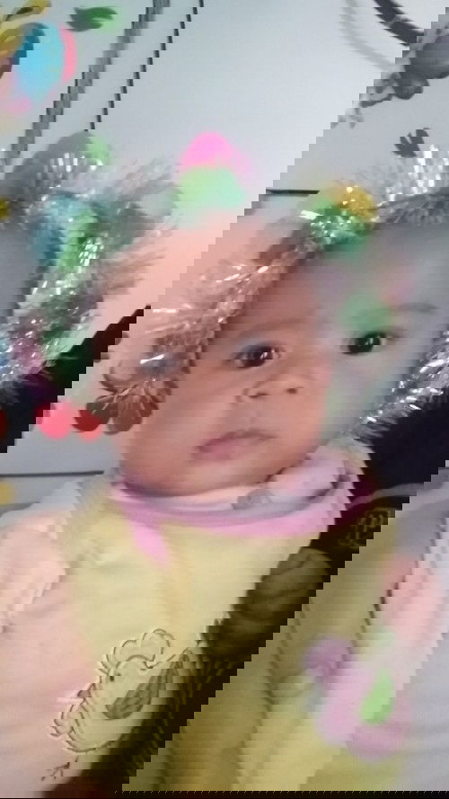 Belum bisa merangkak padahal udh mau 8 bln