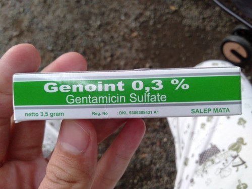 Mata belekan pada bayi