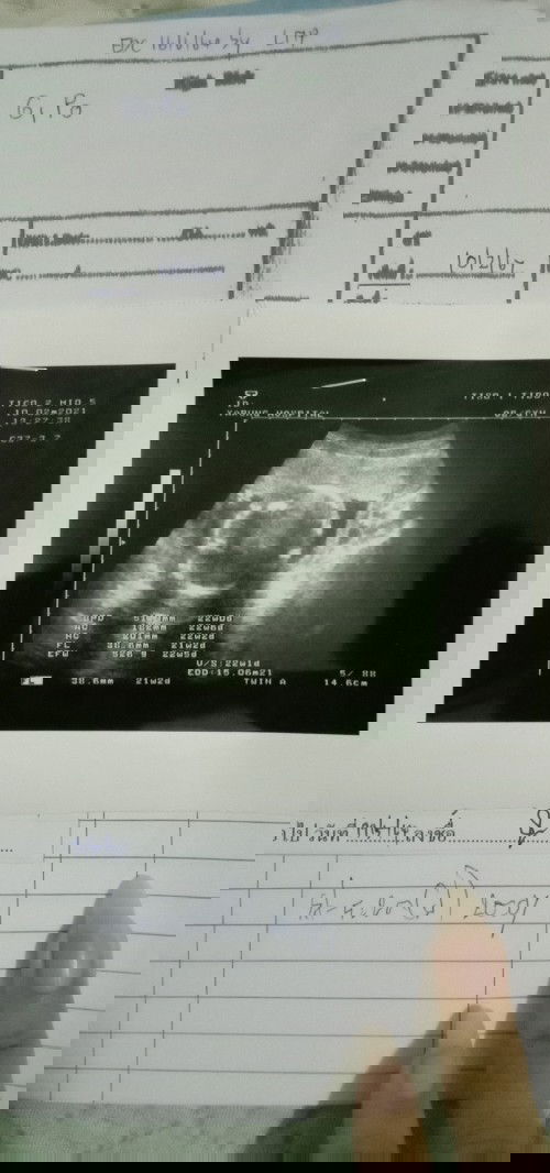 ขอถามแม่หน่อยค่ะ