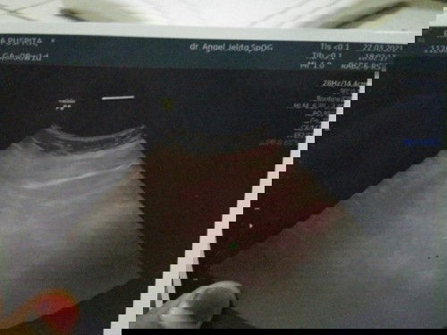 Ga hamill 😭😭😭