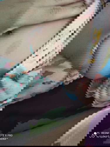 Có m nào biết bé nhà em bị j ko ạ