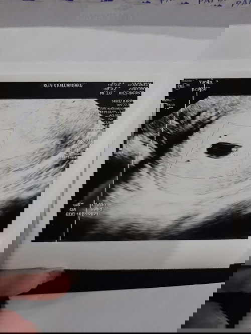 USG transvagina di 6w