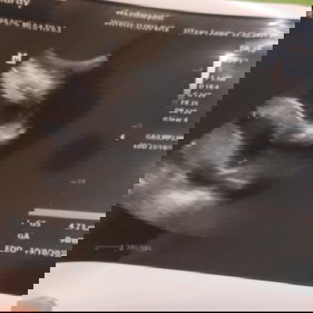 Janin belum terlihat