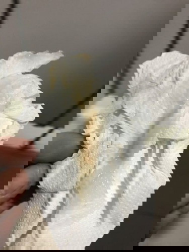 ตกขาว หรือมูกเลือดคะ