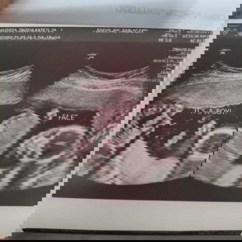 I have a Baby Boy 💙