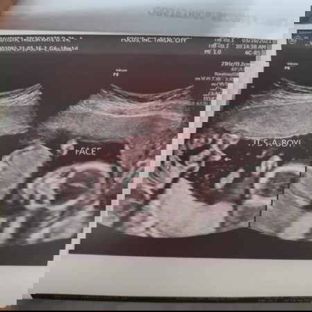 I have a Baby Boy π