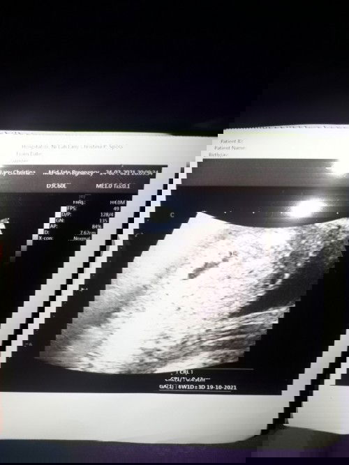 Hamil 4 minggu 1 hari ni bun