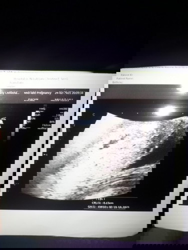 Hamil 4 minggu 1 hari ni bun