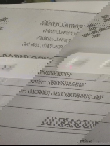 Dinugo pero positive pa din sa PT need advice please